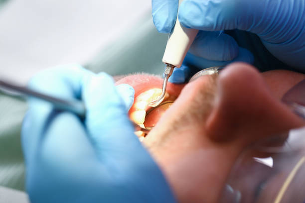 Best Emergency Treatment for Oral Infections in Hanna City, IL